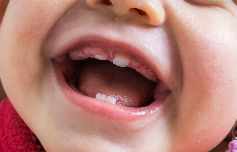 denti-da-latte-quando-cadono-sintomi