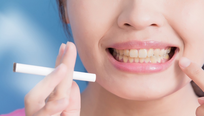 sigaretta-e-denti-relazione
