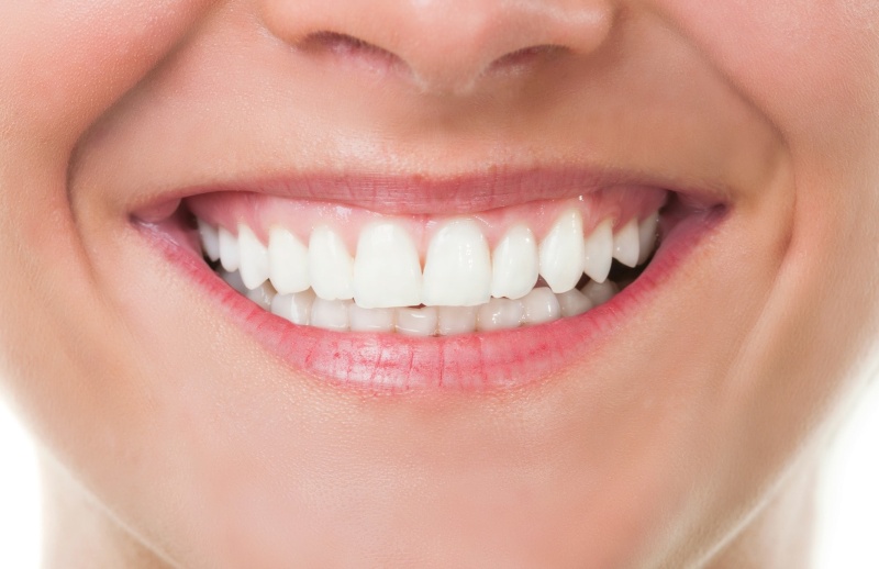 denti-e-collagene