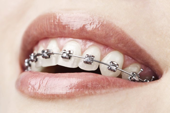 implantologia-dentale