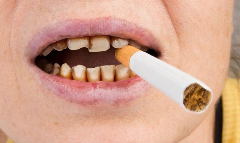 sigaretta-e-denti-danni